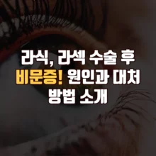 라식 라섹 비문증 원인 대처 방법