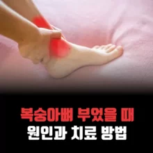 복숭아뼈-부음-원인
