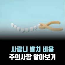 사랑니-발치-비용-주의사항