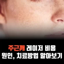 주근깨-레이저-비용-원인-치료