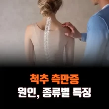 척추-측만증-원인-종류