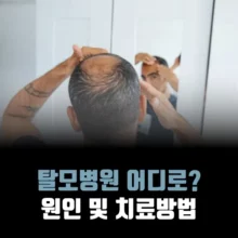 탈모병원-어디로-원인-치료