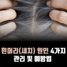 흰머리-원인-새치-예방법