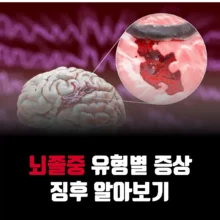 뇌졸중-증상-유형-예방법