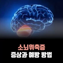 소뇌위축증-증상-예방-방법