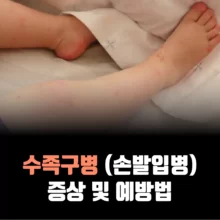 수족구병-증상-예방법