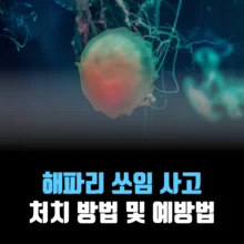 해파리-사고-예방법