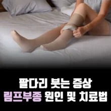 림프부종-증상-원인-치료방법