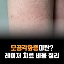모공각화증-원인-닭살피부-치료