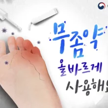 무좀약-종류-순위-사용법