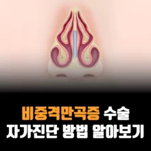 비중격만곡증-수슬-자가진단