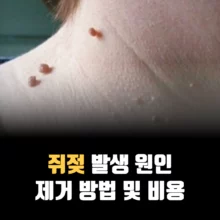 쥐젖-제거-안하면-비용