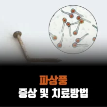 파상풍-증상-치료방법