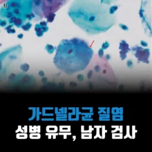 가드넬라균-남자-성병-검사-질염