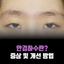 안검하수-증상-개선-방법
