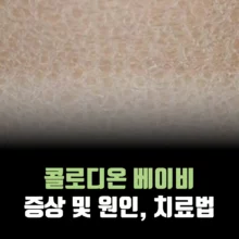 콜로디온-베이비-성인-증상-원인
