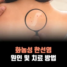 화농성-한선염-원인-고름