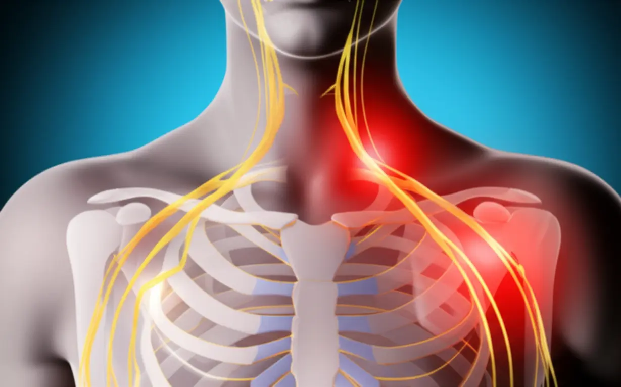 목이나-팔꿈치-신경-문제로-인한-손저림을-보여주는-3D-이미지