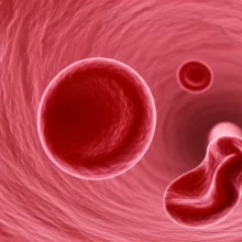 Stylized-red-blood-cells-showing-normal-vs-low-levels-in-a-blood-vessel.