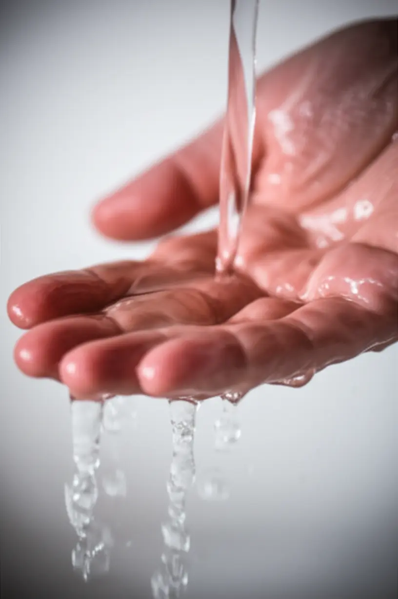 뜨거운-물-화상-후-즉시-찬물에-손을-담그는-모습